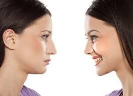 Rhinoplasty Surgeon