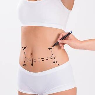 Liposuction Procedure In Riyadh