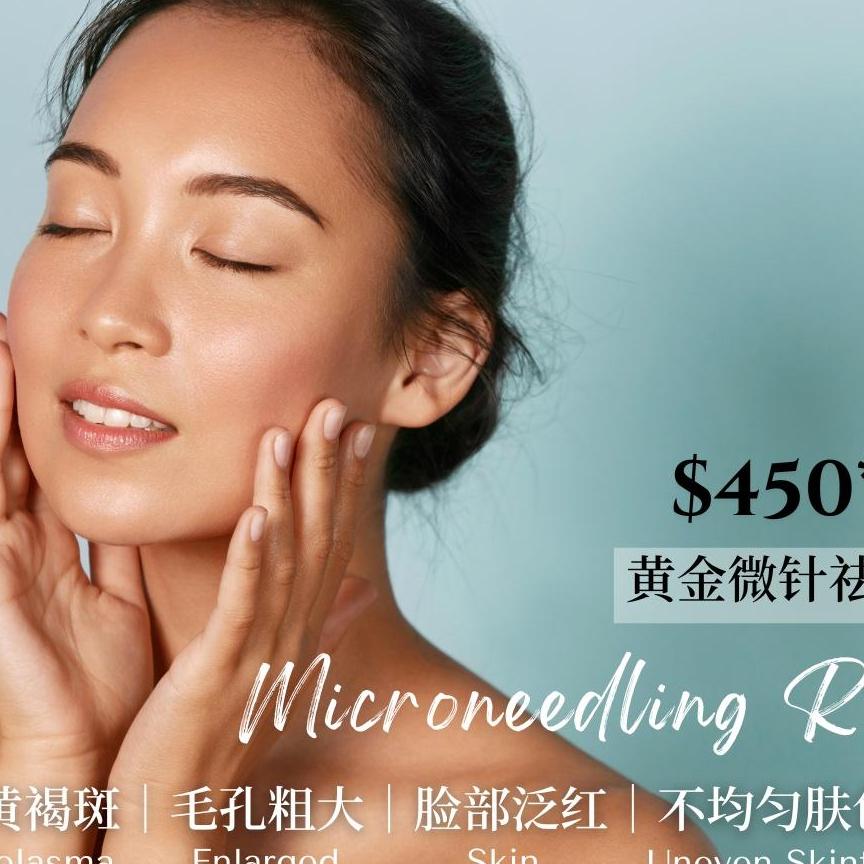Sylfirm X Microneedling  Singapore